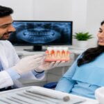 gum treatment for bleeding gums
