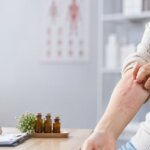Homeopathy for Urticaria (Hives)