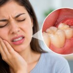 wisdom teeth hurting gums